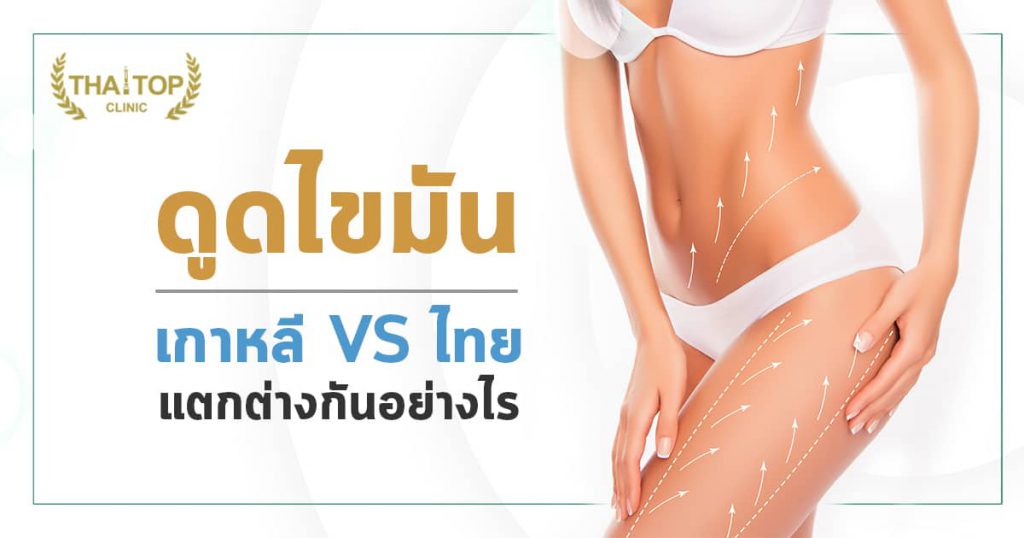 ดูดไขมันที่เกาหลี VS ดูดไขมันที่ไทย แตกต่างกันอย่างไร